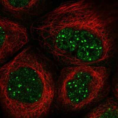 Immunocytochemistry/Immunofluorescence: SH3BP5 Antibody [NBP1-80796] - Staining of human cell line A-431 shows localization to nucleoplasm & nuclear bodies.