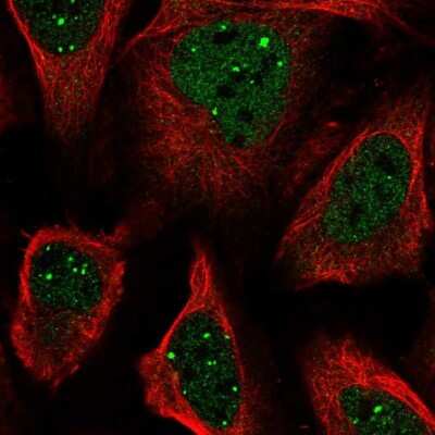 Immunocytochemistry/Immunofluorescence: SH3BP5 Antibody [NBP2-58311] - Staining of human cell line U-2 OS shows localization to nucleoplasm & nuclear bodies.
