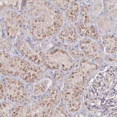 Immunohistochemistry-Paraffin: SH3BP5 Antibody [NBP1-80796] - Staining of human Kidney shows moderate granular cytoplasmic positivity in cells in tubules.