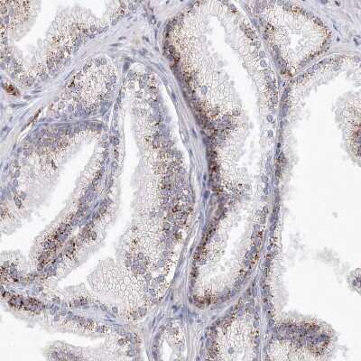 Immunohistochemistry-Paraffin: SH3BP5 Antibody [NBP1-80796] - Staining of human Prostate shows moderate granular cytoplasmic positivity in glandular cells.