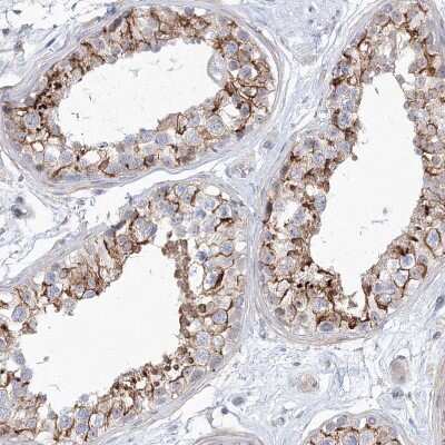 Immunohistochemistry-Paraffin: SH3BP5 Antibody [NBP1-80796] - Staining of human Testis shows moderate granular cytoplasmic positivity in cells in seminiferous ducts.