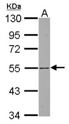 Western Blot: SH3BP5 Antibody [NBP2-20344] - Sample (30 ug of whole cell lysate) A: Jurkat 10% SDS PAGE gel, diluted at 1:1000.