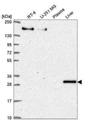 Western Blot: SH3BP5 Antibody [NBP2-58311] - Western blot analysis in human cell line RT-4, human cell line U-251 MG, human plasma and human liver tissue.