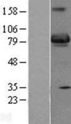 Western Blot: SH3BP5 Overexpression Lysate (Adult Normal) [NBP2-07817] Left-Empty vector transfected control cell lysate (HEK293 cell lysate); Right -Over-expression Lysate for SH3BP5.