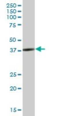 Western Blot: SH3GL3 Antibody [H00006457-B01P] - Analysis of SH3GL3 expression in rat brain.