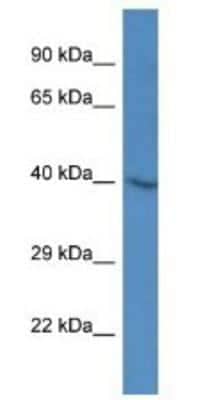 Western Blot: SH3GL3 Antibody [NBP1-79630] - Mouse Brain Lysate 1ug/ml  Gel Concentration 12%