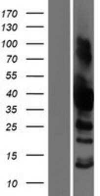 Western Blot: SH3GL3 Overexpression Lysate (Adult Normal) [NBP2-08046] Left-Empty vector transfected control cell lysate (HEK293 cell lysate); Right -Over-expression Lysate for SH3GL3.