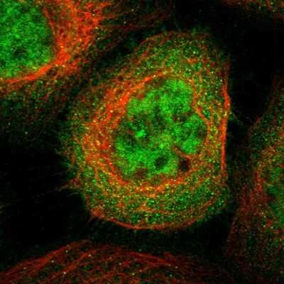 Immunocytochemistry/Immunofluorescence: SH3GLB2 Antibody [NBP1-81367] - Immunofluorescent staining of human cell line A-431 shows localization to nucleoplasm & cytosol.