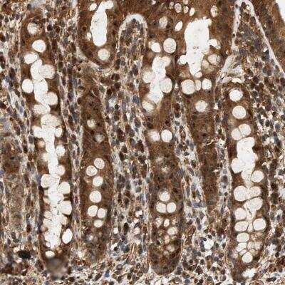 Immunohistochemistry: SH3GLB2 Antibody [NBP1-81367] - Staining of human rectum shows moderate positivity in glandular cells.
