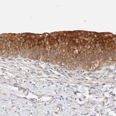 Immunohistochemistry: SH3GLB2 Antibody [NBP1-81368] - Staining of human urinary bladder shows strong cytoplasmic positivity in urothelial cells.