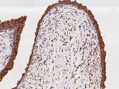 Immunohistochemistry-Paraffin: SH3GLB2 Antibody [NBP2-97456] - Immunochemical staining of human SH3GLB2 in human urinary bladder with rabbit polyclonal antibody at 1:100 dilution, formalin-fixed paraffin embedded sections.