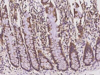 Immunohistochemistry-Paraffin: SH3GLB2 Antibody [NBP2-97456] - Immunochemical staining of human SH3GLB2 in human rectum with rabbit polyclonal antibody at 1:100 dilution, formalin-fixed paraffin embedded sections.