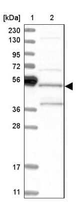 Western Blot: SH3GLB2 Antibody [NBP1-81367] - Lane 1: Marker  [kDa] 230, 130, 95, 72, 56, 36, 28, 17, 11.  Lane 2: Human cell line RT-526