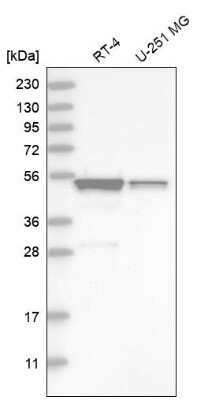 Western Blot: SH3GLB2 Antibody [NBP1-81368] - Analysis in human cell line RT-4 and human cell line U-251 MG.