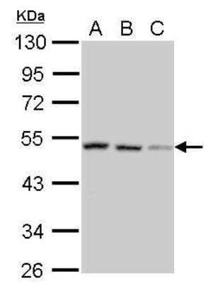 Western Blot: SH3GLB2 Antibody [NBP2-20346] - A. 30 ug NT2D1 whole cell lysate/extract  B. 30 ug IMR32 whole cell lysate/extract  C. 30 ug MCF-7 whole cell lysate/extract 10 % SDS-PAGE SH3GLB2 antibody dilution: 1:1000