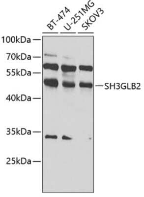 Western Blot: SH3GLB2 Antibody [NBP3-04587] - Analysis of extracts of various cell lines, using SH3GLB2 antibody at 1:1000 dilution. Secondary antibody: HRP Goat Anti-Rabbit IgG (H+L) at 1:10000 dilution. Lysates/proteins: 25ug per lane. Blocking buffer: 3% nonfat dry milk in TBST. Detection: ECL Bas