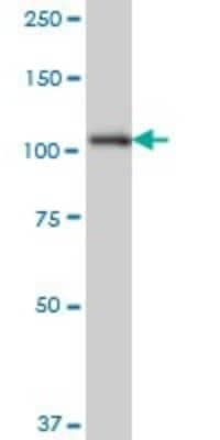 Western Blot SH3MD2 Antibody (3H3)