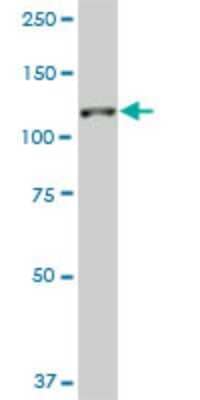 Western Blot SH3MD2 Antibody (3H3)