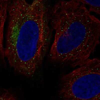 Immunocytochemistry/Immunofluorescence: SH3MD2 Antibody [NBP2-68988] - Staining of human cell line U-2 OS shows localization to intermediate filaments & vesicles.