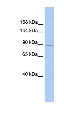 Western Blot: SH3MD2 Antibody [NBP1-54972] - Titration: 0.2-1 ug/ml, Positive Control: DU145 cell lysate.