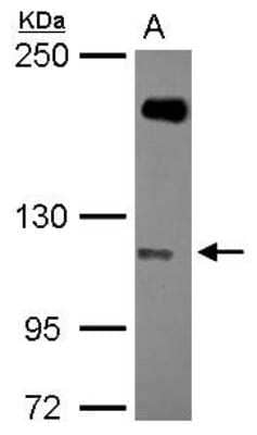 Western Blot: SH3MD2 Antibody [NBP2-20347] - Sample (30 ug of whole cell lysate) A: U87-MG 5% SDS PAGE gel, diluted at 1:1000.