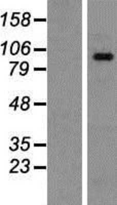 Western Blot: SH3MD2 Overexpression Lysate (Adult Normal) [NBP2-06597] Left-Empty vector transfected control cell lysate (HEK293 cell lysate); Right -Over-expression Lysate for SH3MD2.