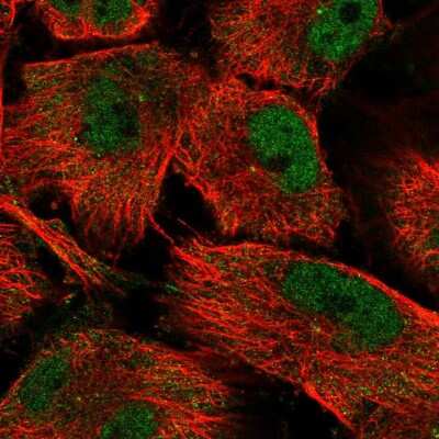Immunocytochemistry/Immunofluorescence: SH3MD4 Antibody [NBP2-31005] - Immunofluorescent staining of human cell line U-251 MG shows localization to nucleoplasm, cytosol & centrosome.