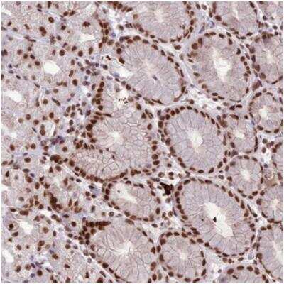 Immunohistochemistry: SH3MD4 Antibody [NBP2-31028] - Staining of human stomach, lower shows strong nuclear positivity in glandular cells.