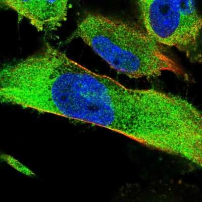 Immunocytochemistry/Immunofluorescence: SH3PX1 Antibody [NBP2-58144] - Staining of human cell line U-251 MG shows localization to plasma membrane & cytosol.