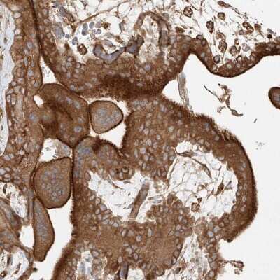 Immunohistochemistry-Paraffin: SH3PX1 Antibody [NBP1-80777] - Staining of human placenta shows strong cytoplasmic and membranous positivity in trophoblastic cells.