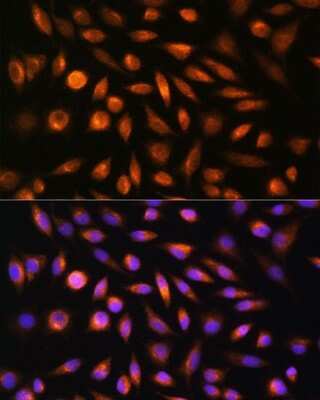 Immunocytochemistry/Immunofluorescence: SH3PXD2A Antibody [NBP3-16808] - Immunofluorescence analysis of L929 cells using SH3PXD2A Rabbit pAb (NBP3-16808) at dilution of 1:100. Blue: DAPI for nuclear staining.