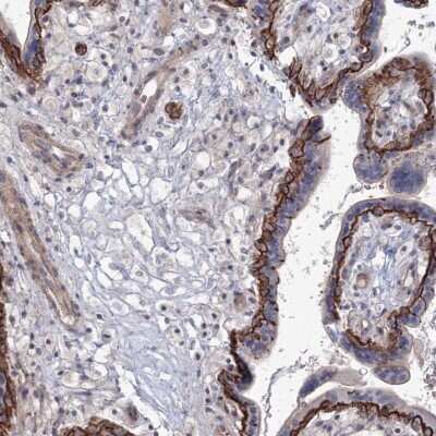 Immunohistochemistry-Paraffin: SH3PXD2A Antibody [NBP1-90455] - Staining of human placenta shows strong membranous positivity in trophoblastic cells.