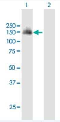 Western Blot: SH3PXD2A Antibody [H00009644-B01P-50ug] - Analysis of SH3PXD2A expression in transfected 293T cell line (H00009644-T01) by SH3PXD2A MaxPab polyclonal antibody.  Lane 1: SH3PXD2A transfected lysate(121.55 KDa). Lane 2: Non-transfected lysate.