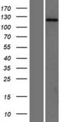 Western Blot SH3PXD2A Overexpression Lysate