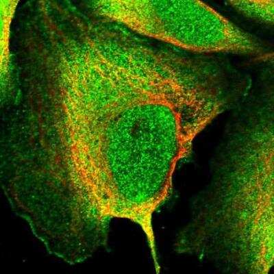 Immunocytochemistry/Immunofluorescence: SH3PXD2B Antibody [NBP1-93965] - Staining of human cell line U-2 OS shows localization to nucleus & plasma membrane. Antibody staining is shown in green.