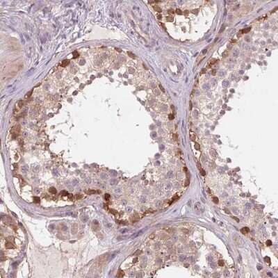 Immunohistochemistry-Paraffin: SH3RF2 Antibody [NBP2-38841] - Staining of human testis shows strong cytoplasmic positivity in a subset of cells in seminiferous ducts.