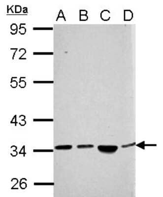 Western Blot: SH3YL1 Antibody [NBP2-20349] - Sample (30 ug of whole cell lysate) A: NT2D1 B: PC-3 C: U87-MG D: SK-N-SH 10% SDS PAGE gel, diluted at 1:1000.