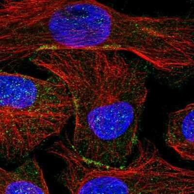 Immunocytochemistry/Immunofluorescence: SHANK1 Antibody [NBP1-87016] - Staining of human cell line U-2 OS shows localization to plasma membrane.