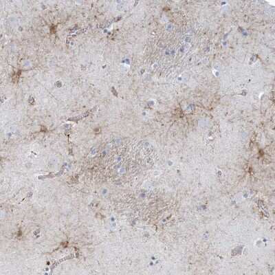 Immunohistochemistry-Paraffin: SHANK1 Antibody [NBP1-87016] - Staining of human lateral ventricle shows strong positivity in glial cells.