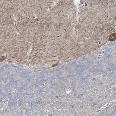 Immunohistochemistry-Paraffin: SHANK1 Antibody [NBP2-33971] - Staining of human placenta shows strong cytoplasmic positivity in trophoblastic cells.