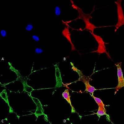 Immunocytochemistry/Immunofluorescence: SHANK1 Antibody (N22/21) [NBP2-12915] - Immunocytochemistry/Immunofluorescence analysis using Mouse Anti-SHANK1 Monoclonal Antibody, Clone S22-21 (NBP2-12915). Tissue: Neuroblastoma cells (SH-SY5Y). Species: Human. Fixation: 4% PFA for 15 min. Primary Antibody: Mouse Anti-SHANK1 Monoclonal Antibody (NBP2-12915) at 1:50 for overnight at 4C with slow rocking. Secondary Antibody: AlexaFluor 488 at 1:1000 for 1 hour at RT. Counterstain: Phalloidin-iFluor 647 (red) F-Actin stain; Hoechst (blue) nuclear stain at 1:800, 1.6mM for 20 min at RT. (A) Hoechst (blue) nuclear stain. (B) Phalloidin-iFluor 647 (red) F-Actin stain. (C) SHANK1 Antibody (D) Composite.