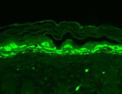 Immunohistochemistry: SHANK1 Antibody (N22/21) [NBP2-12915] - Immunohistochemistry analysis using Mouse Anti-SHANK1 Monoclonal Antibody, Clone S22-21 (NBP2-12915). Tissue: backskin. Species: Mouse. Fixation: Bouin's Fixative and paraffin-embedded. Primary Antibody: Mouse Anti-SHANK1 Monoclonal Antibody (NBP2-12915) at 1:100 for 1 hour at RT. Secondary Antibody: FITC Goat Anti-Mouse (green) at 1:50 for 1 hour at RT. Localization: Filaggrin-like staining (upper layer aggregations of staining).