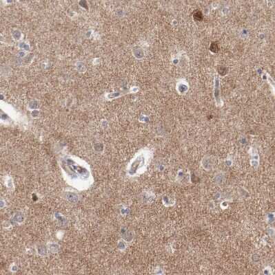 Immunohistochemistry-Paraffin: SHANK3 Antibody [NBP1-82900] - Staining of human cerebral cortex shows moderate positivity in neuropil.