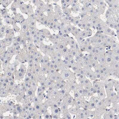 Immunohistochemistry-Paraffin: SHANK3 Antibody [NBP1-82900] - Staining of human liver shows no positivity in hepatocytes as expected.