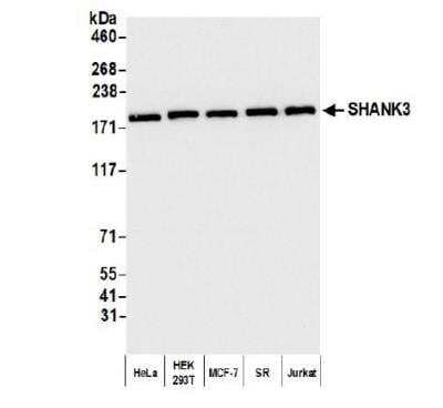 Western Blot: SHANK3 Antibody [NBP2-32085] - Whole cell lysate (10 ug) from HeLa, HEK293T, MCF-7, SR, and Jurkat cells prepared using NETN lysis buffer. Antibody: Affinity purified rabbit anti-SHANK3 antibodyused for WB at 0.04 ug/ml. Detection: Chemiluminescence with an exposure time of 3 seconds.