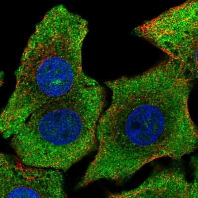 Immunocytochemistry/Immunofluorescence: SHB Antibody [NBP2-58223] - Staining of human cell line A549 shows localization to nucleoplasm & cytosol.