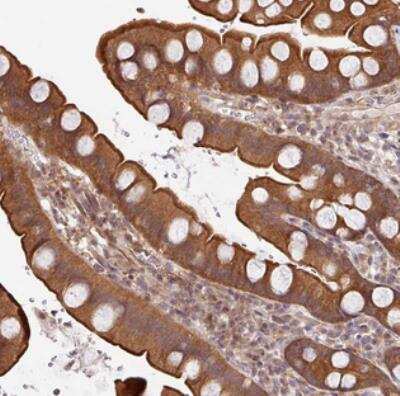 Immunohistochemistry: SHB Antibody [NBP2-30557] - Staining of human small intestine shows moderate cytoplasmic and membranous positivity in glandular cells.
