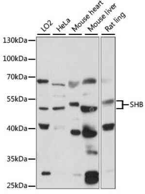 Western Blot: SHB Antibody [NBP2-94662] - Analysis of extracts of various cell lines, using SHB at 1:1000 dilution. Secondary antibody: HRP Goat Anti-Rabbit IgG (H+L) at 1:10000 dilution. Lysates/proteins: 25ug per lane. Blocking buffer: 3% nonfat dry milk in TBST. Detection: ECL Basic Kit . Exposure time: 90s.