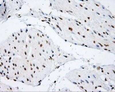 Immunohistochemistry: SHC1 Antibody (OTI3A1) - Azide and BSA Free [NBP2-74167] - Staining of paraffin-embedded bladder tissue using anti-SHC1 mouse monoclonal antibody.