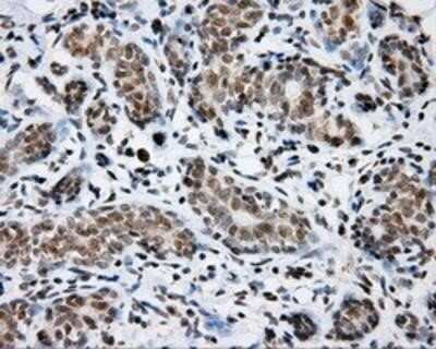 Immunohistochemistry: SHC1 Antibody (OTI3A1) - Azide and BSA Free [NBP2-74167] - Staining of paraffin-embedded breast tissue using anti-SHC1 mouse monoclonal antibody.